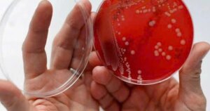 vi khuan 1773632326860920712497 0 65 302 548 crop 17736333265371644613079