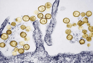 virus