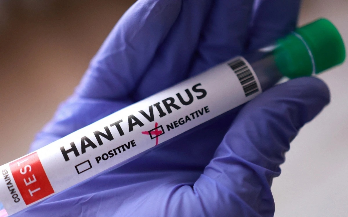 virus Hanta ong xet nghiem virus duong tinh am tinh reu 0