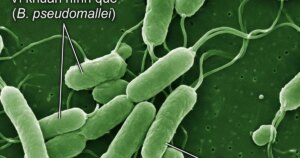 wmo 17768522280681962480459 0 0 750 1200 crop 177685228998198243017