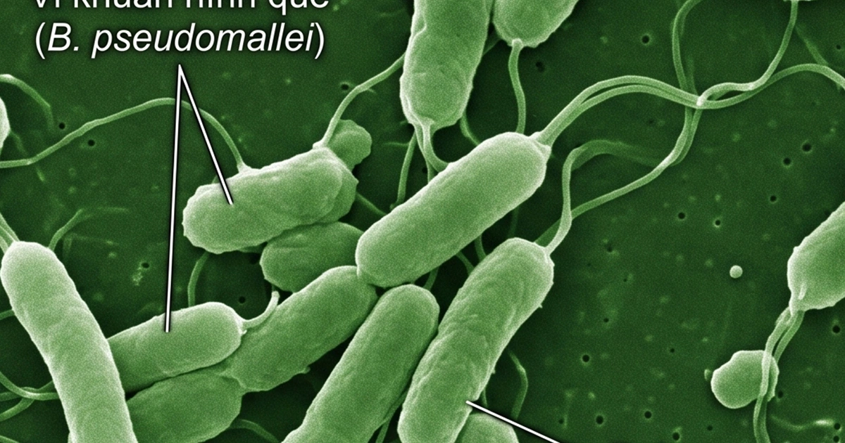 wmo 17768522280681962480459 0 0 750 1200 crop 177685228998198243017