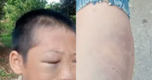 xac minh clip be trai mat bam tim nghi nhieu lan bi bao hanh 683
