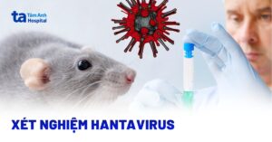 xet nghiem hantavirus