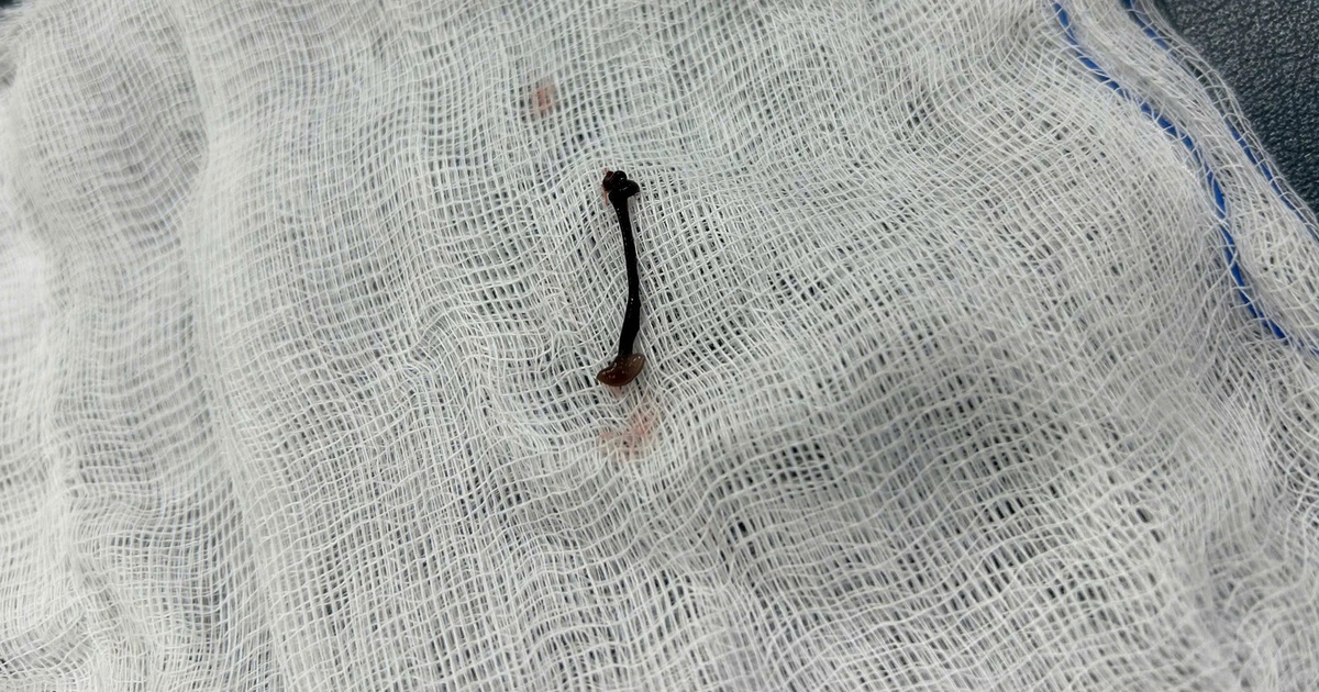 Z7382827680479653A2C425D946B30B6Ff84Eb17Fb54C9 17671494772871855782838 0 0 1340 2560 Crop 1767149541