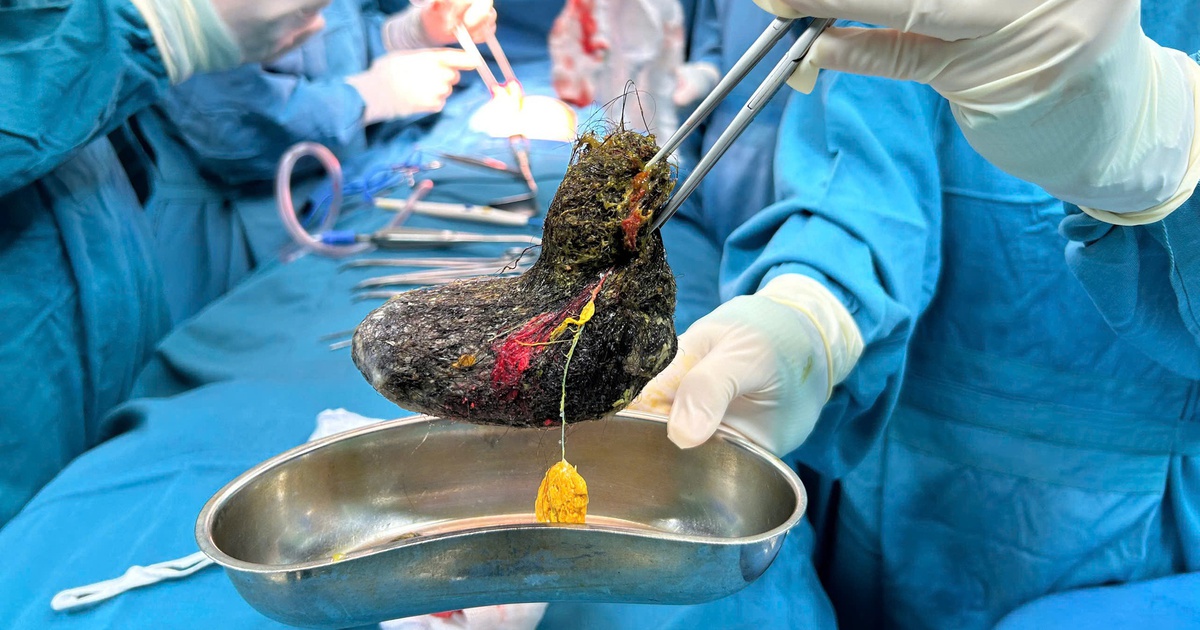 z77596458991975a081668108dee9453500a085a1fba15 17770295188871801214510 320 0 1920 2560 crop 17770297